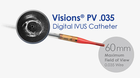 محصولات مصرفی کمپانی Philips Volcano به سه دسته طبقه بندی می شوند : کتترهای تشخیصی وابسته به دستگاه اولتراسوند داخل عروق IVUS گایدوایر های فشار دستگاه FFR & iFR کتتر های درمانی دستگاه آترکتومی